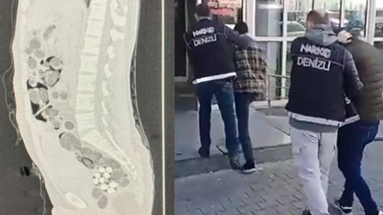 Yolcunun midesinden 219 paket uyuşturucu çıktı