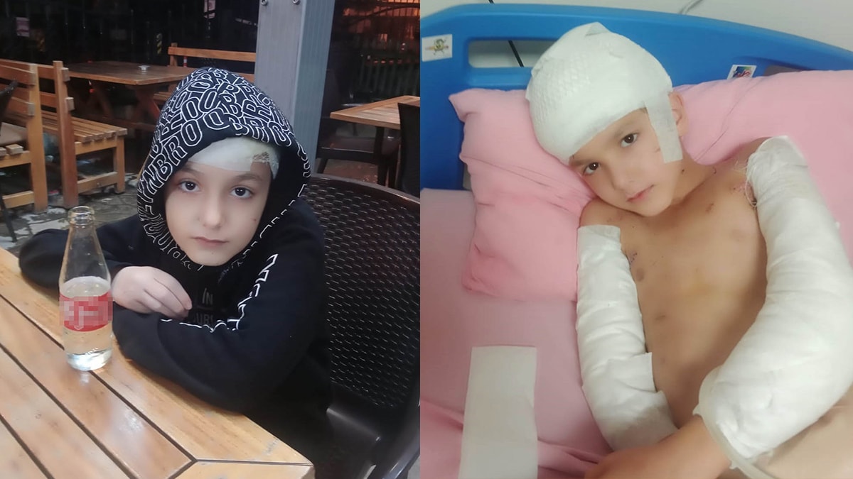 Ankara'da köpek saldırısı: İki belediye yetkilisine dava açıldı