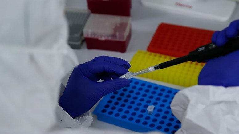 Sağlık Bakanlığı'ndan tarama testi açıklaması