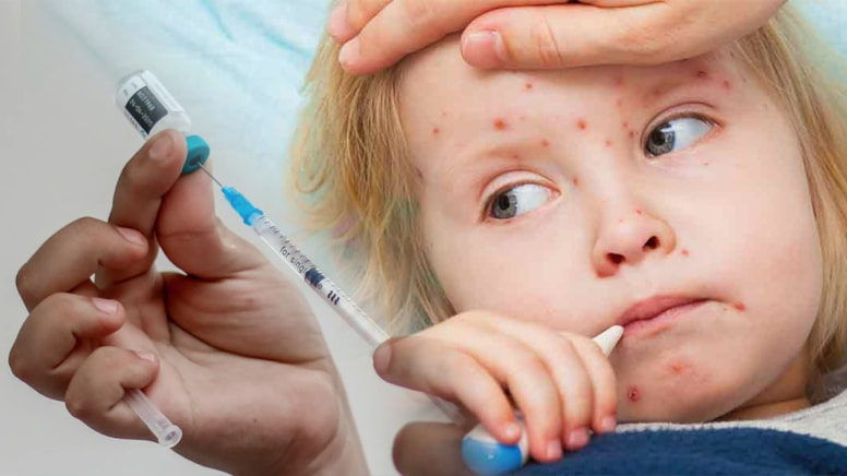 Aşı karşıtı, Sağlık Bakanı oldu: 10 yıl sonra bir çocuk kızamık sebebiyle öldü