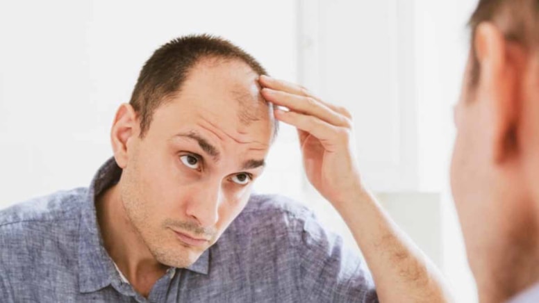 Erkekleri uyardı: Bu içeceklerin sık tüketilmesi saç dökülmesini hızlandırıyor