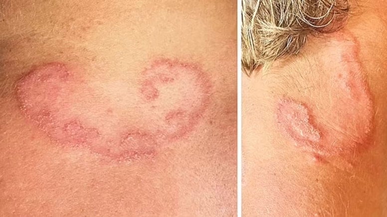 Döküntü sandığı izler parazit çıktı: Sebebi günlük bir aktivite