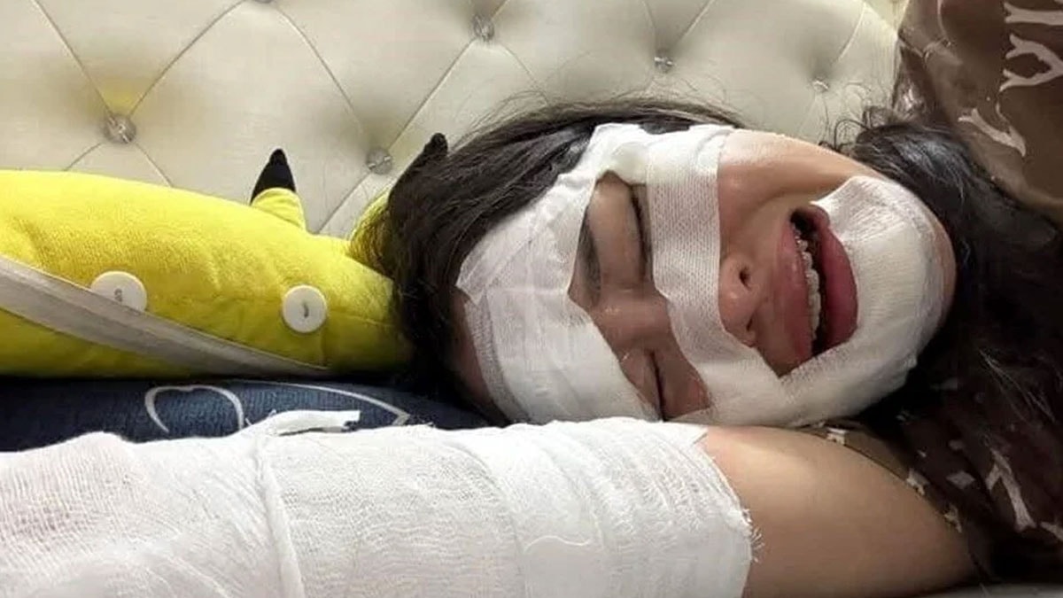 Doğum gününde bir anda patladı, eli ve yüzü yandı: Herkese ders olsun