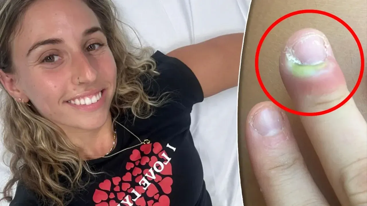 Tırnağının yanındaki deriyi tutup koparınca hastanelik oldu