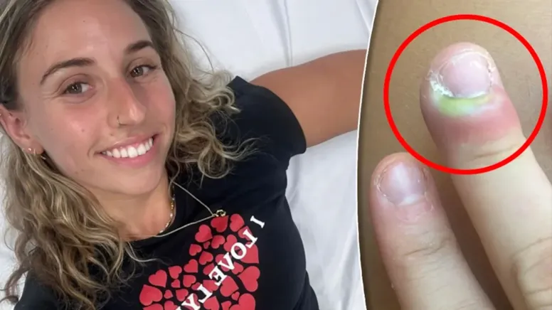 Tırnağının yanındaki deriyi tutup koparınca hastanelik oldu