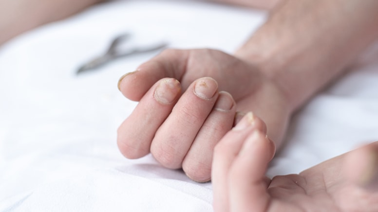 Tırnağınızdaki işaret nadir hastalığa yakalanacağınız anlamına geliyor