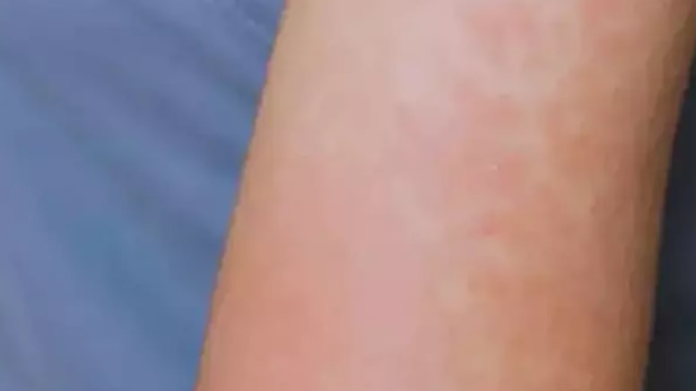 ABD'de salgın alarmı: Vaka sayısı artıyor