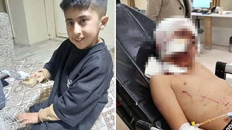 Köpeklerin saldırısına uğrayan küçük Murat, ağır yaralandı