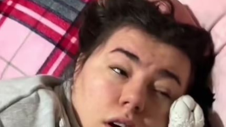 Güneş yanığı sandı, felç geçirdi! Nedeni ortaya çıktı - Sözcü