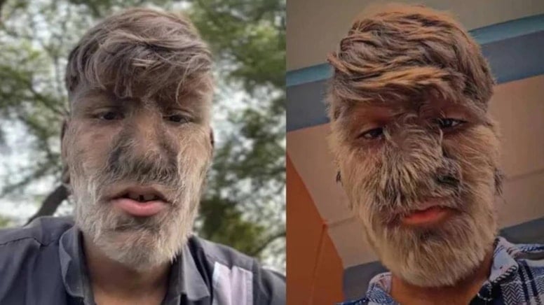 Dünyanın en kıllı insanı! Rekorlar kitabına girdi
