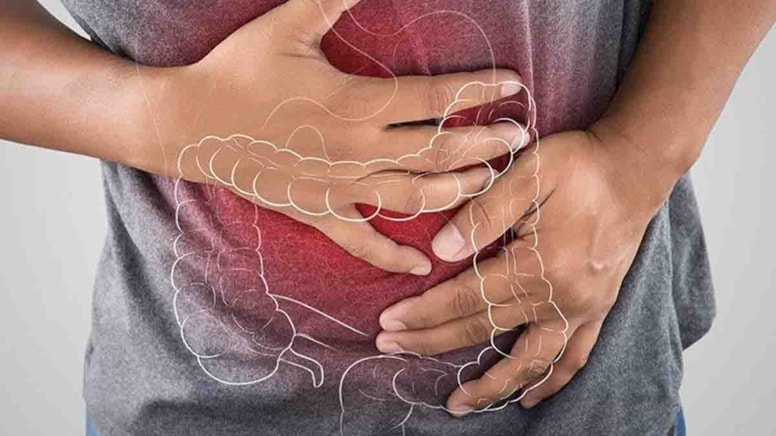 Kolan kanseri Türkiye'de artıyor, Almanya'da azalıyor: Sebebi de beslenme değil!