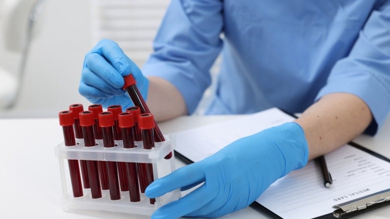 Mide ve pankreas kanseri oranı yüksek olan kan grupları tespit edildi