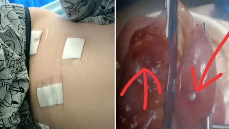 TikTok akımı can alıyordu: 12 yaşındaki çocuk son anda kurtuldu