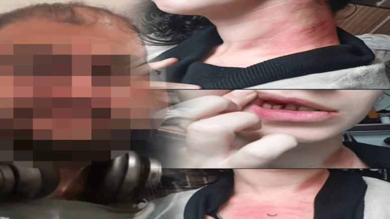 Genç kadın parkta felaketi yaşadı: Boğazına sıktı dişlerini kırdı