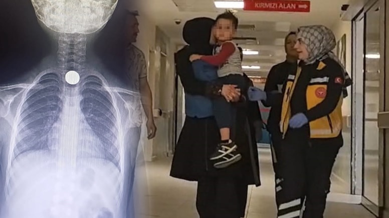 Halının üzerinde bulduğu 50 kuruşu yutan 5 yaşındaki çocuk ölümden döndü
