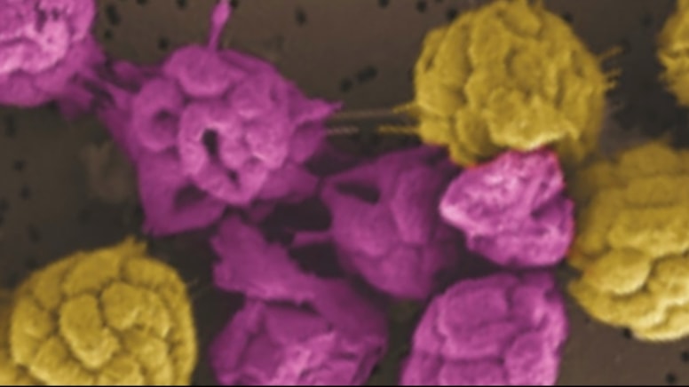 Yaşamı paylaşmadan sürdüremeyen bakteriler keşfedildi: İş bölümü yapıyorlar