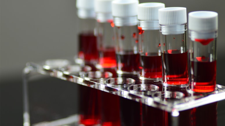 'Yarın başlarım' diyenlerin kan grubu belli oldu: Onlar çok tembeller