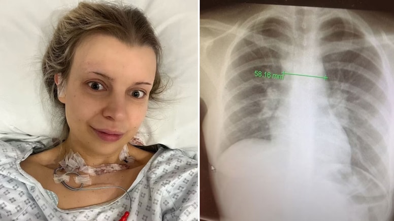 Kanser tedavisi olurken iki farklı kanser daha tetiklendi