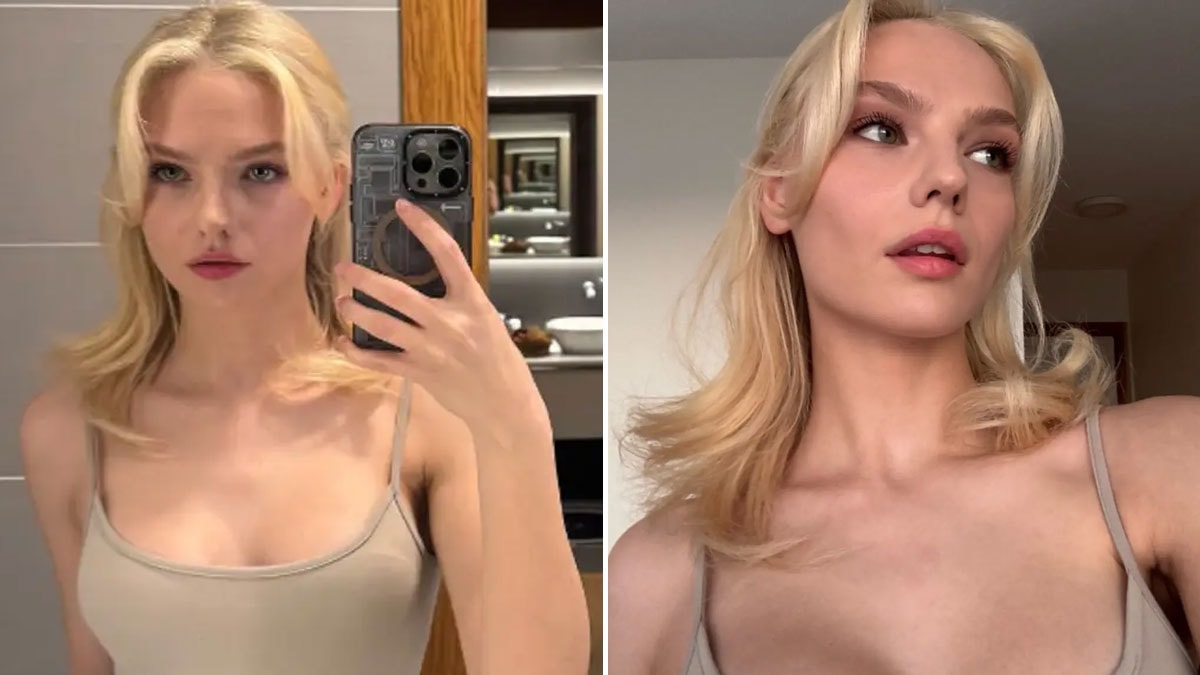 Milyonlarca takipçili Türk yıldız 10 kilo verdi: Kimseler tanıyamadı