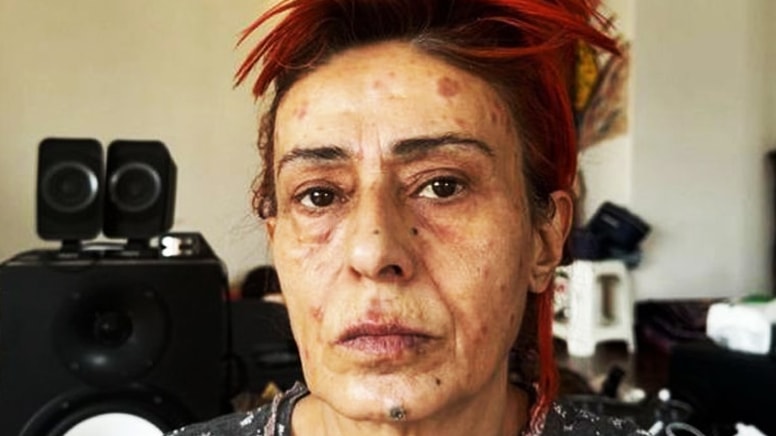 Yıldız Tilbe'den kökten çözüm