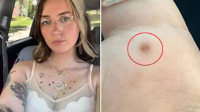 Yapay zekadan fal beklerken hayatı değişti: Acilen doktora görünmelisin