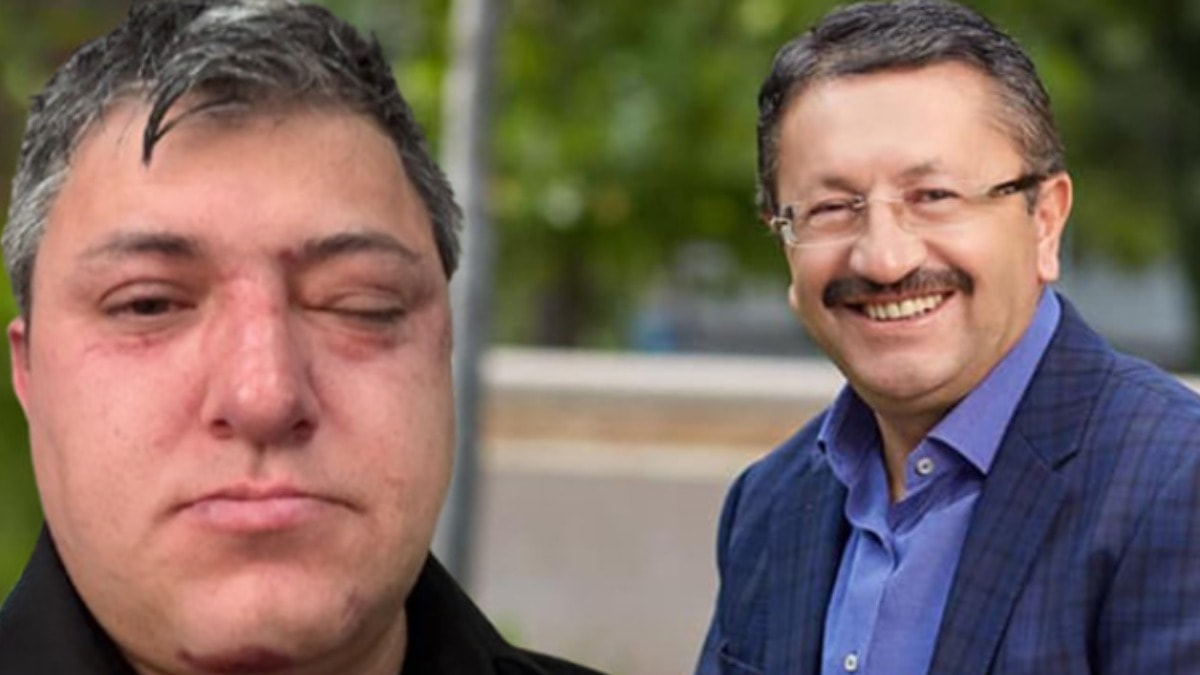Altındağ Belediyesi personelinin darbedilmesine ilişkin soruşturmada zabıta müdürü tutuklandı!