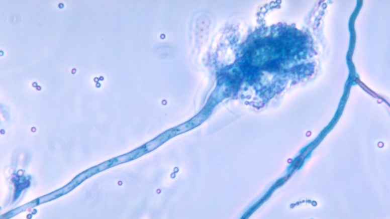 Avrupa ve Asya tehlikede! Ölümcül mantar hastalığı küresel ısınma ile yayılıyor