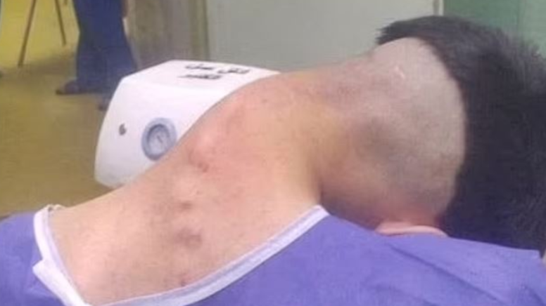 Boynu artık başını taşıyamadı