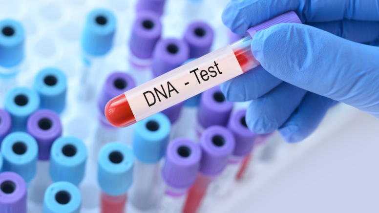 -Eğlencesine DNA testi yaptıran kadın kocasıyla kardeş çıktı