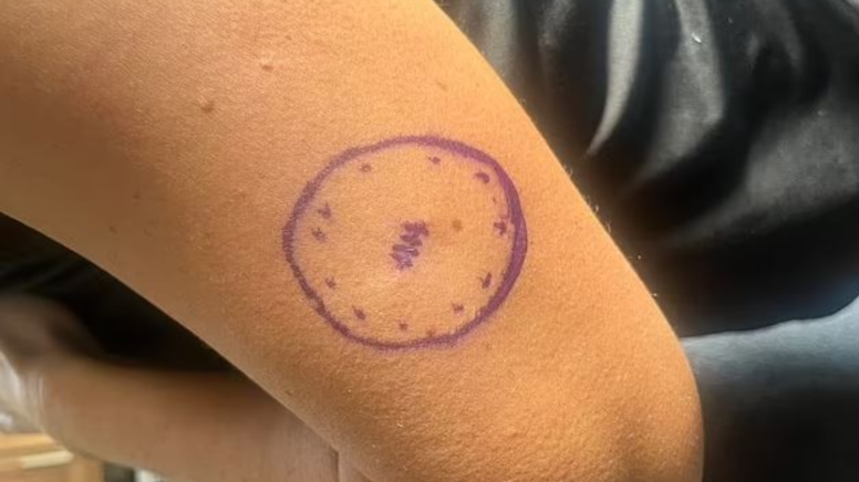 Güneş tutkusu hayatını karattı