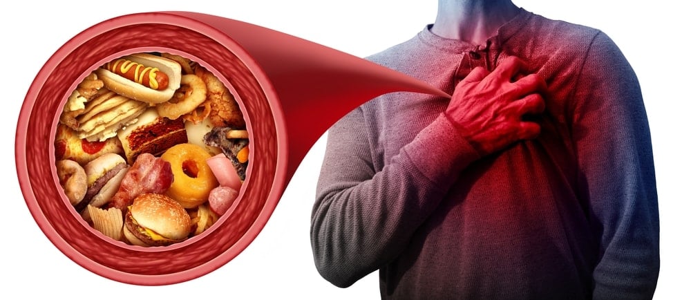 shutterstock2491987069jpg-IOle8kbUHkW4X-PXRfcfdw Haftada 150 dakika vakit harcamanız yeterli!