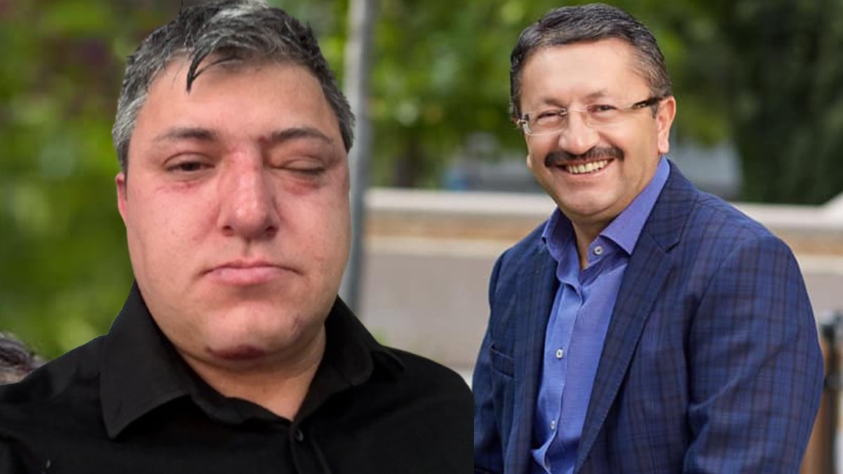 Akılalmaz iddia... Buraya kadar geldik mi? Belediye başkanı ve yardımcıları işçi dövdü