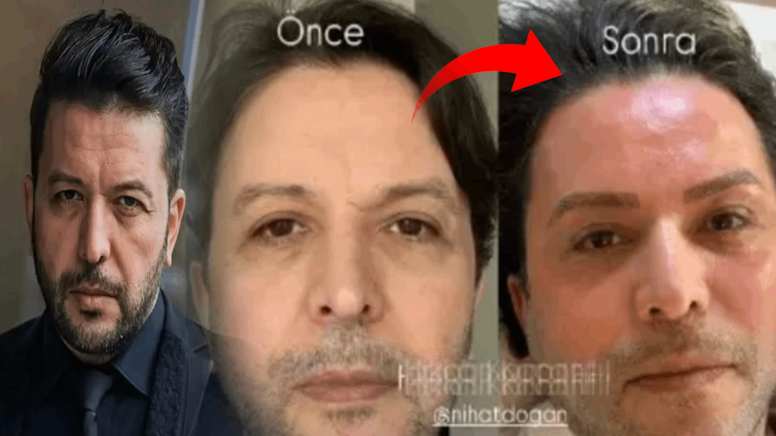 Bu gerçekten Nihat Doğan mı?