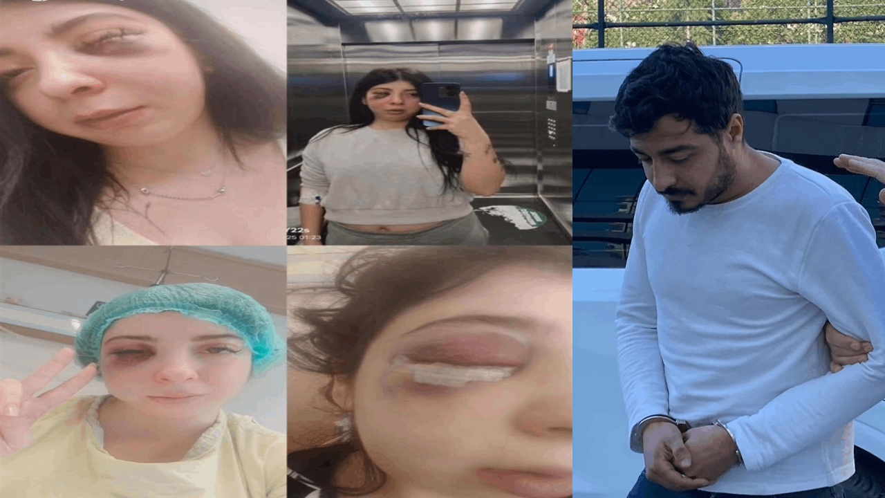 Sokak ortasında dövülen Damla üzen gerçeği anlattı