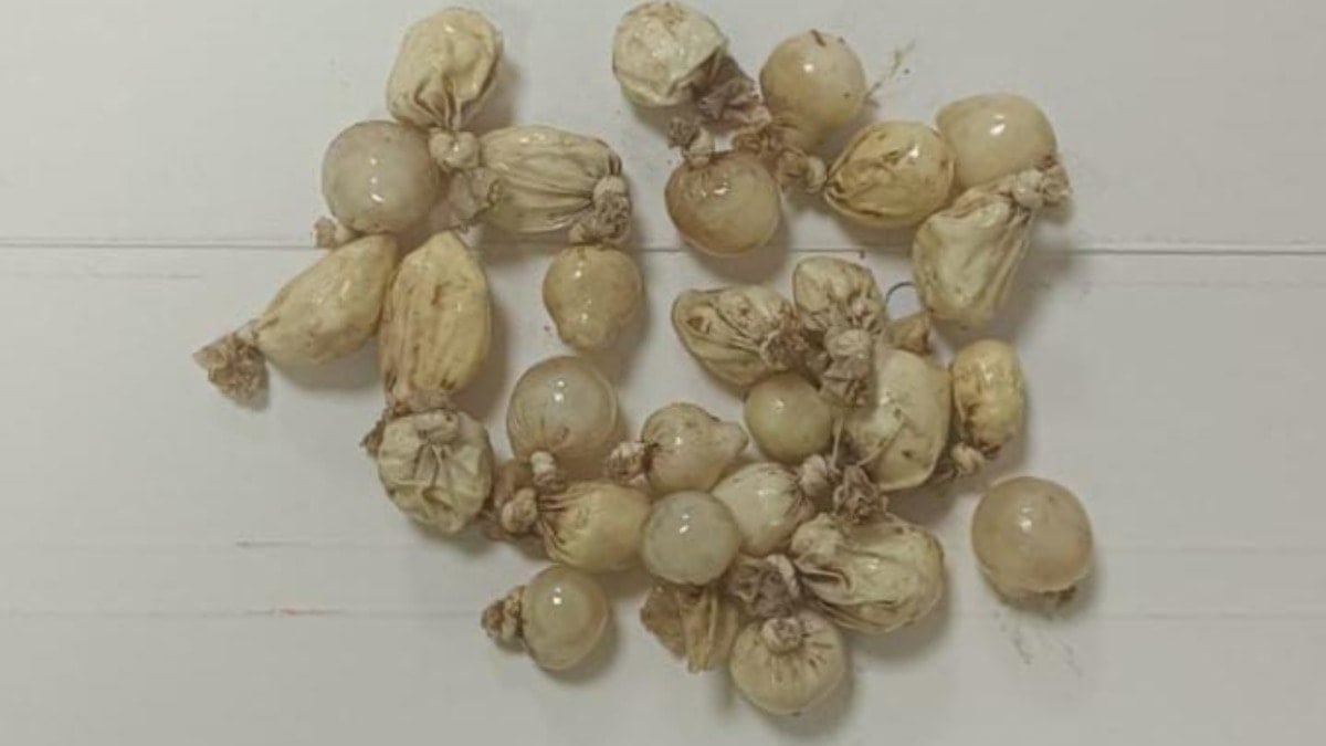 Alkollü sanıldı, midesinden 27 kapsül uyuşturucu çıktı