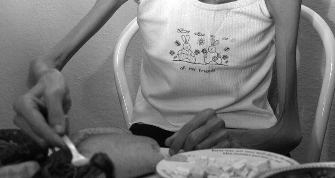 ano7jpg-wtQYQFAi_EO3IHiKXTIpNA Zayıflama baskısı gençleri anoreksiya riskiyle karşı karşıya bırakıyor