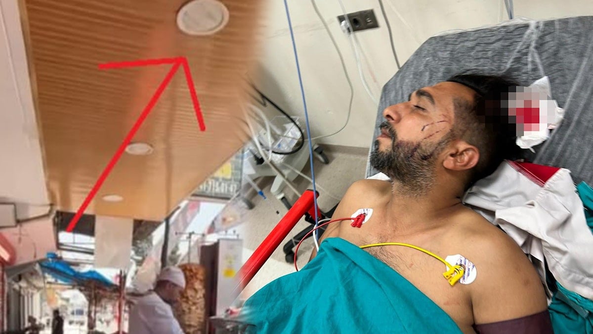 Döner yerken tavandan içeri giren kurşunla ağır yaralandı