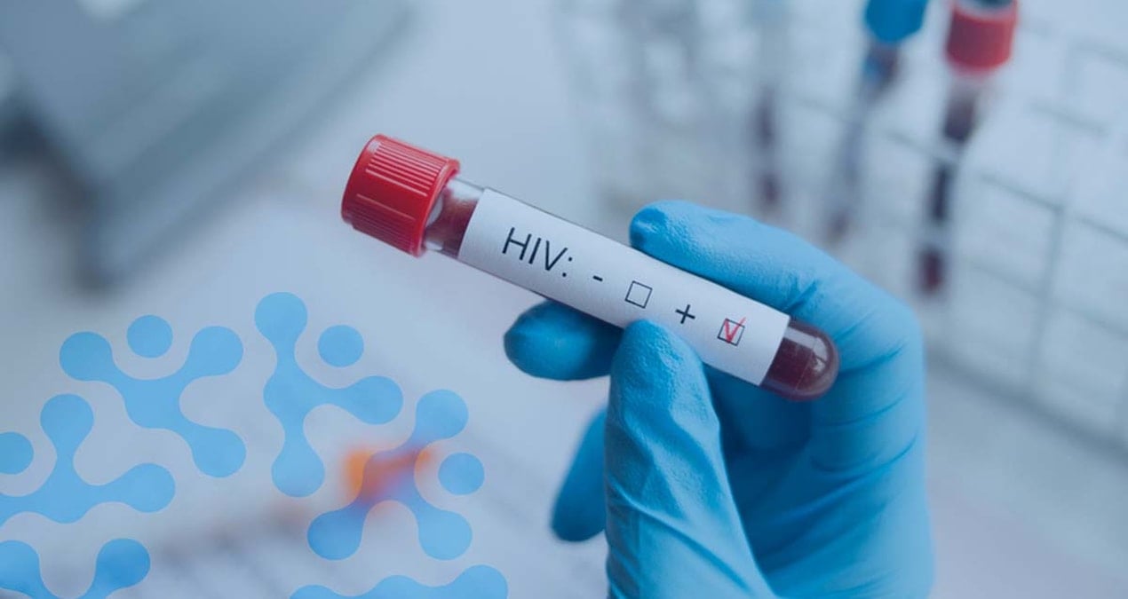 hiv-ic-fotojpg-GL-T8CV7SEmtZ24Eeb07fg HIV tedavisinde devrim niteliğinde yöntem: 'Hepimizi şaşkına çevirdi'