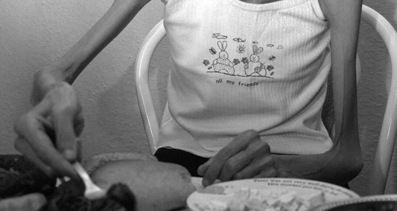 kojpg-U0QQCIFo1E_AnDYx-Aaxiw Anoreksiya nasıl bir hastalık, anoreksiya hastalığının tedavisi yok mu?