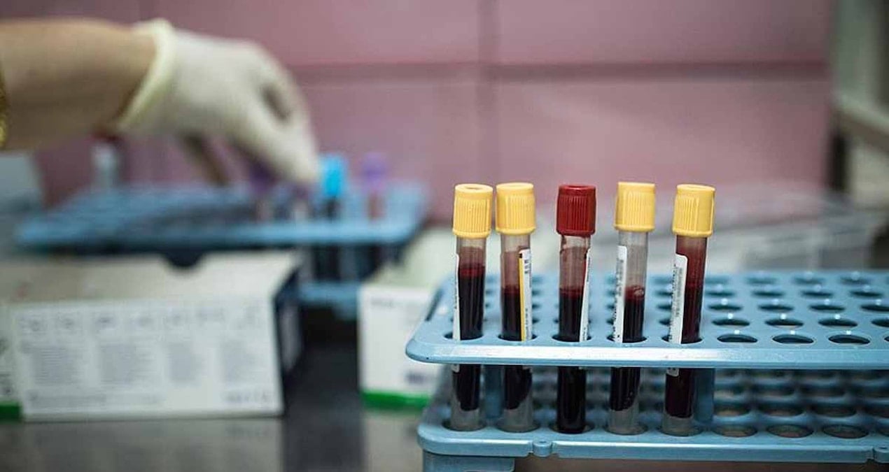 kojpg-mzZYiizJJUSSJIDDeGg8iA Y kuşağının yeni korkulu rüyası bu kanser türü oldu: Neden çıktığı bilinmiyor