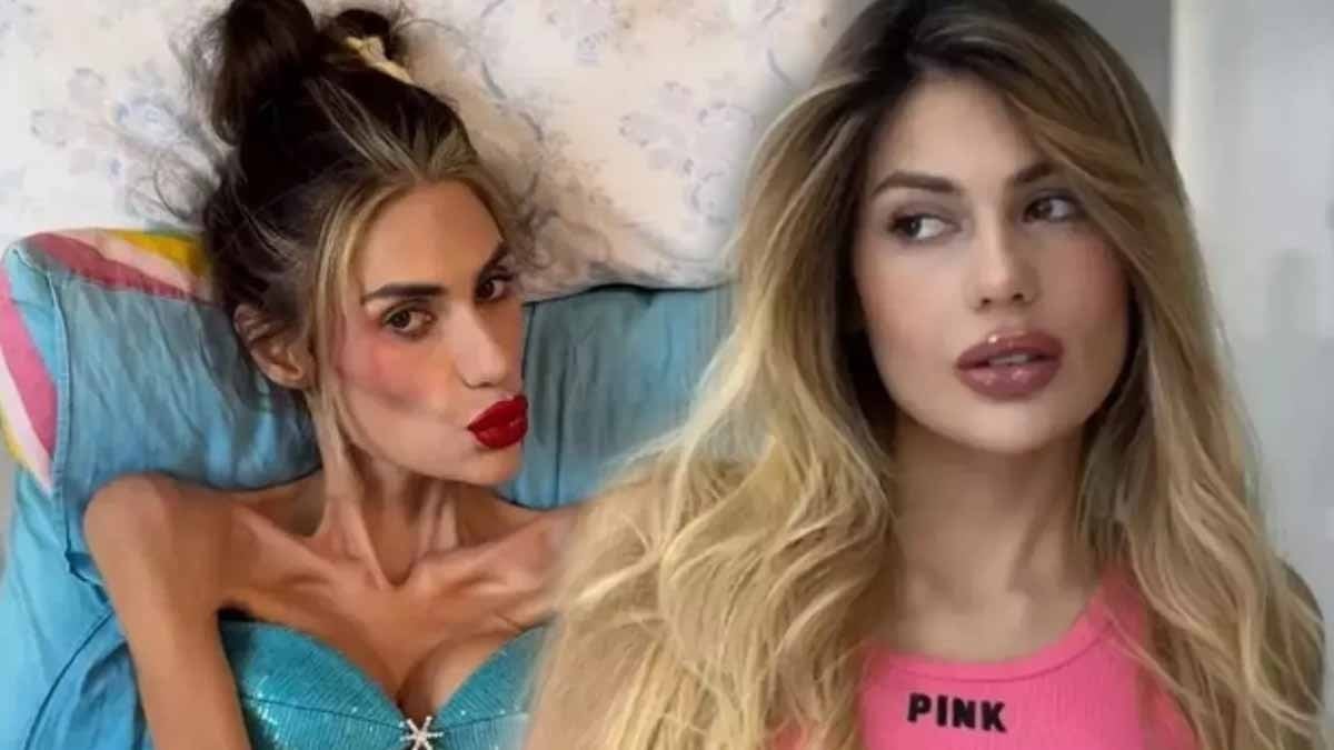 Tedavi altındaydı ama kurtarılamadı! Anoreksiya neden bu kadar ölümcül?