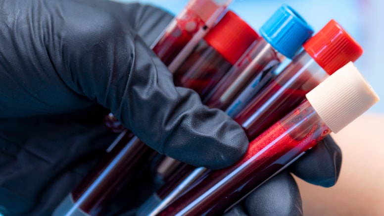 Tek tüp kanla Alzheimer teşhisi: Erken tanı artık mümkün