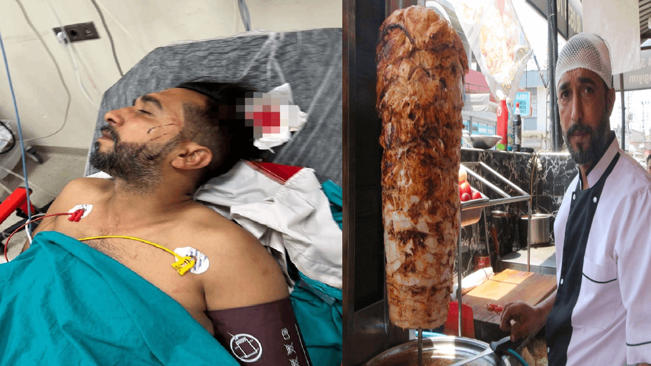 Döner ustasının başına mermi isabet etti