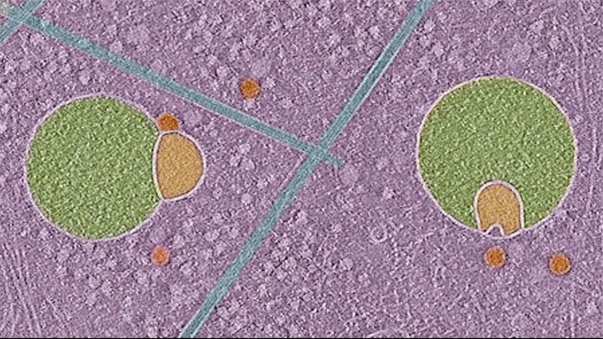 İnsan hücrelerinde hiç görülmemiş organel keşfedildi