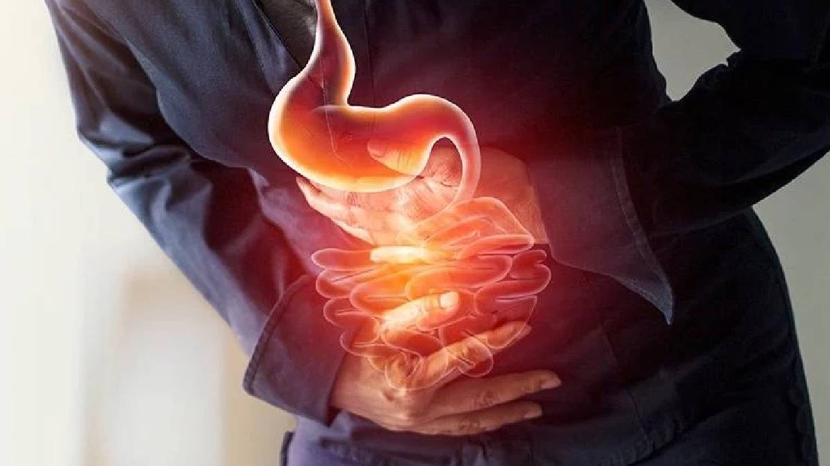 Ne avokado ne de kayısı: Bağırsak için en iyi meyve açıklandı