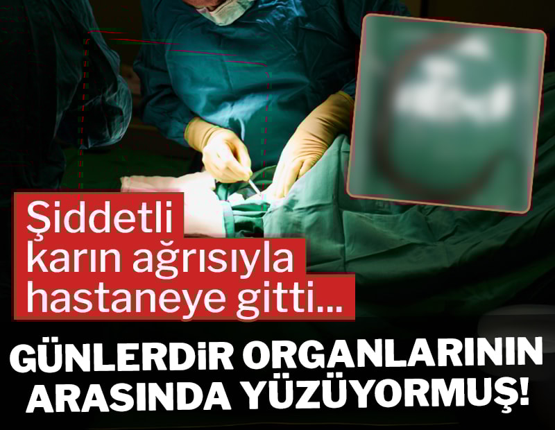 Şiddetli karın ağrısıyla hastaneye gitti... Günlerdir karnında yaşıyormuş