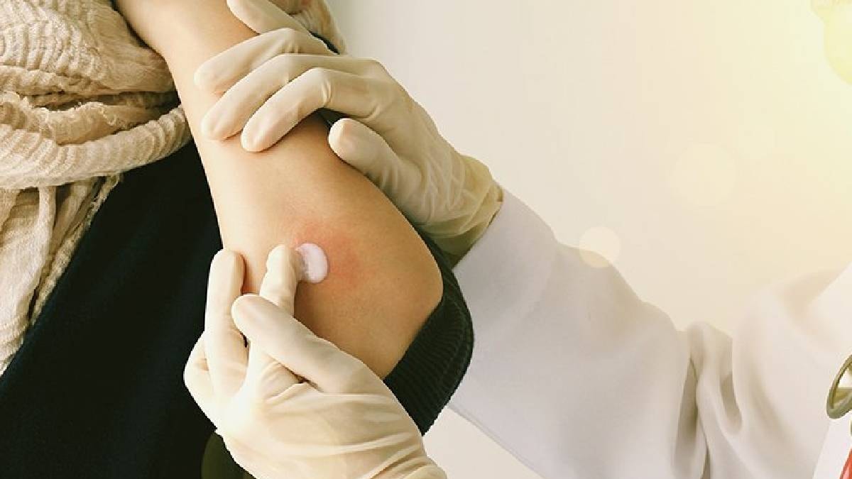 Korkulan oldu penisilin ilacı geri çağrıldı: Uzmanlardan vakalarda patlama uyarısı