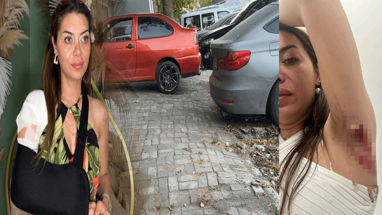 Tamirhane önündeki yağdan kayan kadın yaralandı
