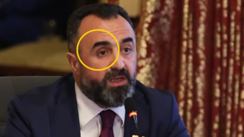 Sağ gözünü eline aldı, vekiller dondu kaldı!