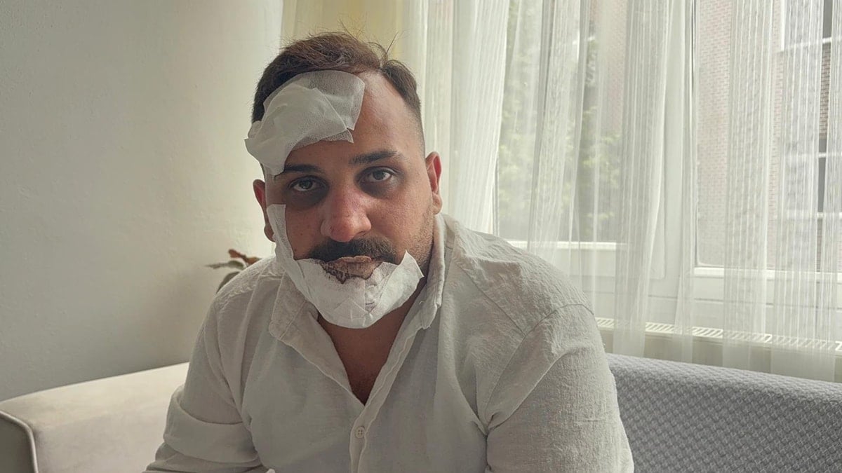 Eski sözlüye, polislerden öldüresiye dayak: 'Sülaleni öldürürüz'